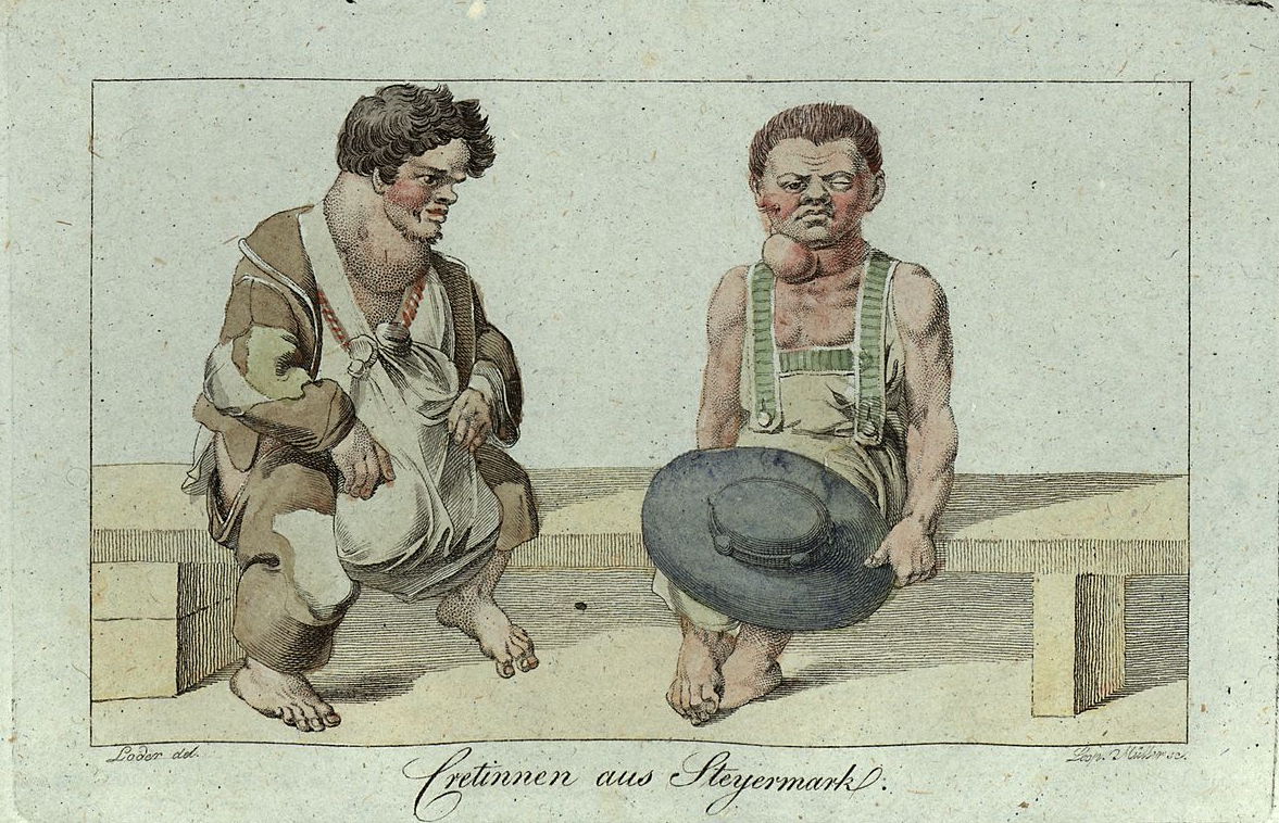 Endemický kretenismus a vole ve Štýrsku, 1819